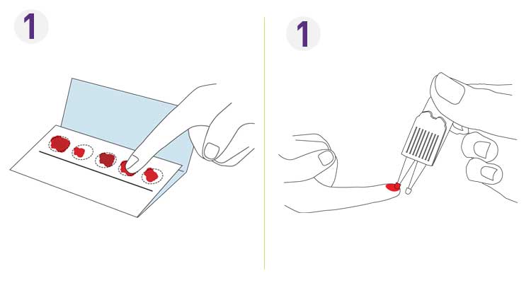 A Better Alternative To Dried Blood Spot Collection Neoteryx